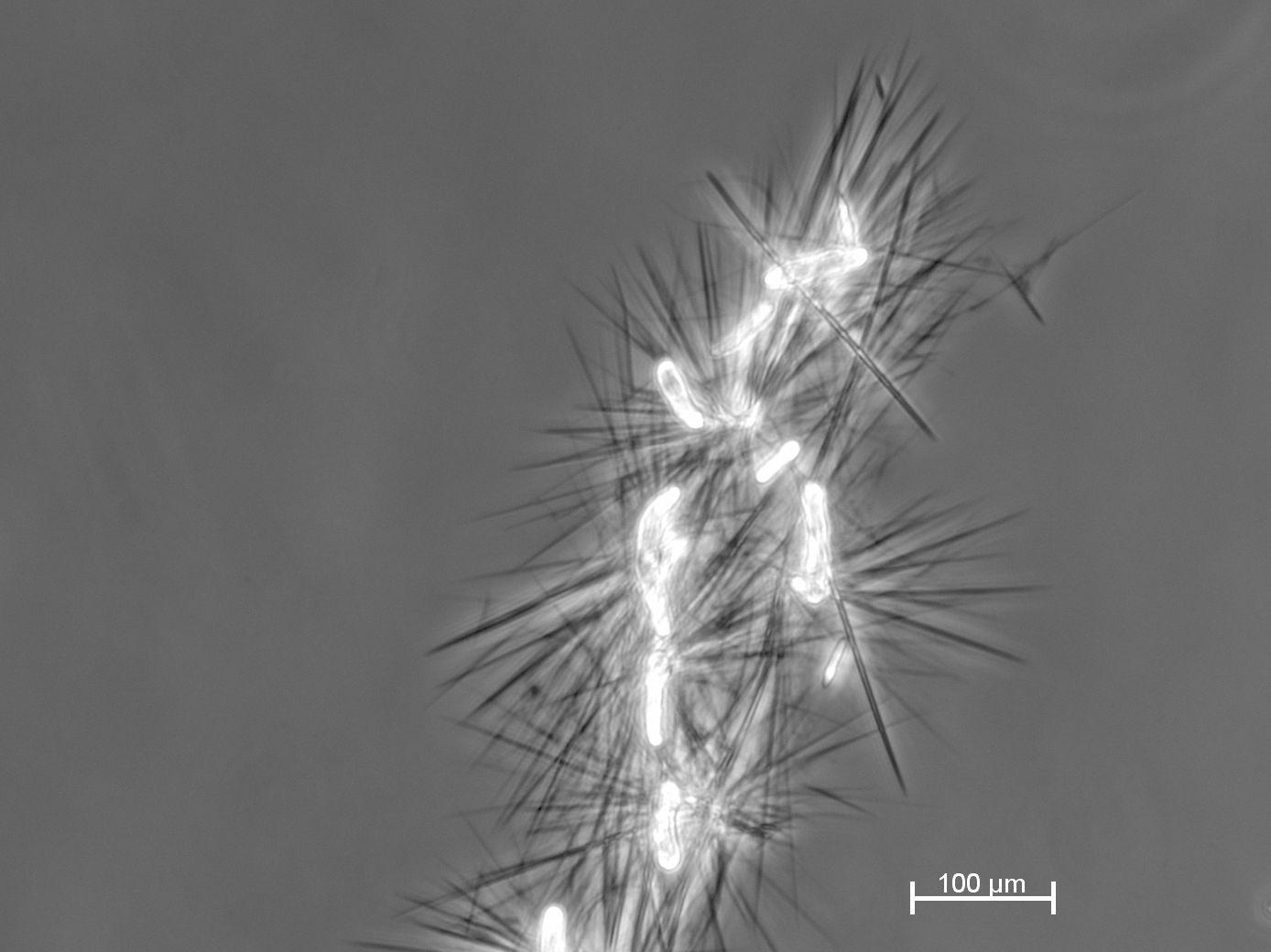 Cellobioselipide (CL) werden als nadelförmige Kristalle aus der mikrobiellen Fermentation gewonnen.