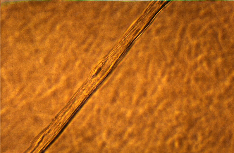 Angiotropin Angiotropin