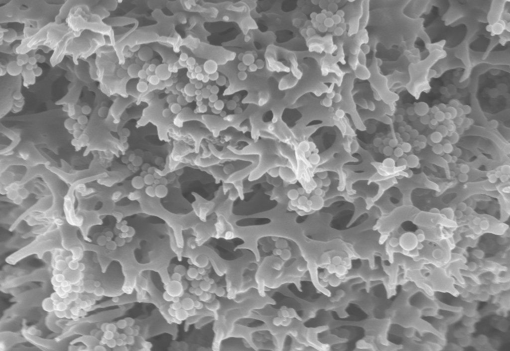 Membranadsorber. Membranadsorber.