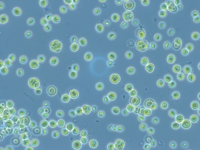 Mikroskopische Aufnahme der Mikroalge Chlorella vulgaris SAG211-12.