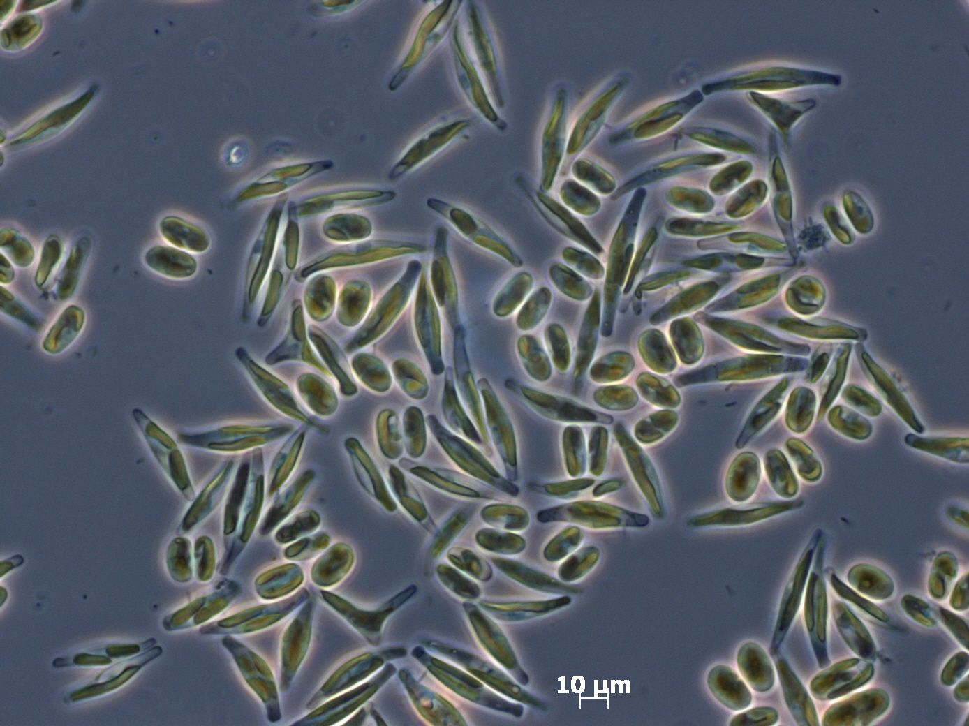 Phaeodactylum tricornutum, mikroskopische Aufnahme.