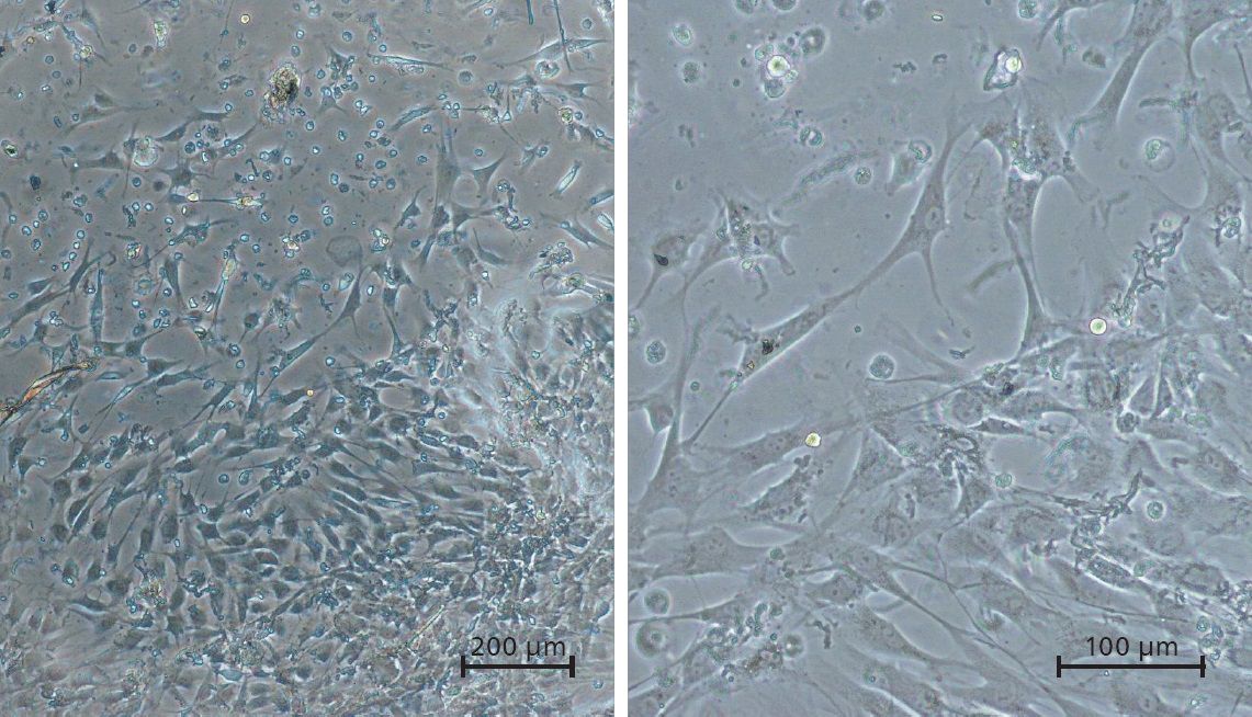 Humane Fibroblasten auf multifunktionellen PEG-Hydrogelen.