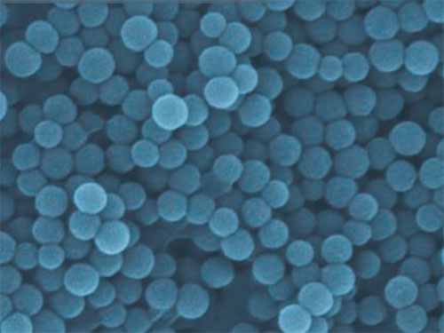 Rasterelektronenmikroskopische Aufnahme bioabbaubarer Nanopartikel.