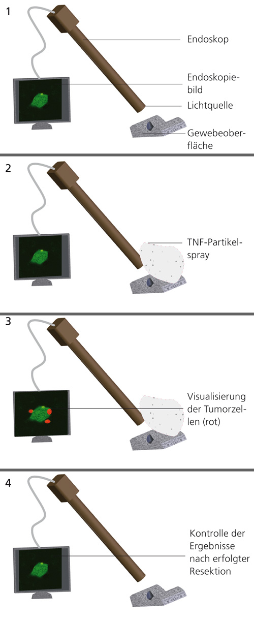  Darstellung des Operationsablaufs.