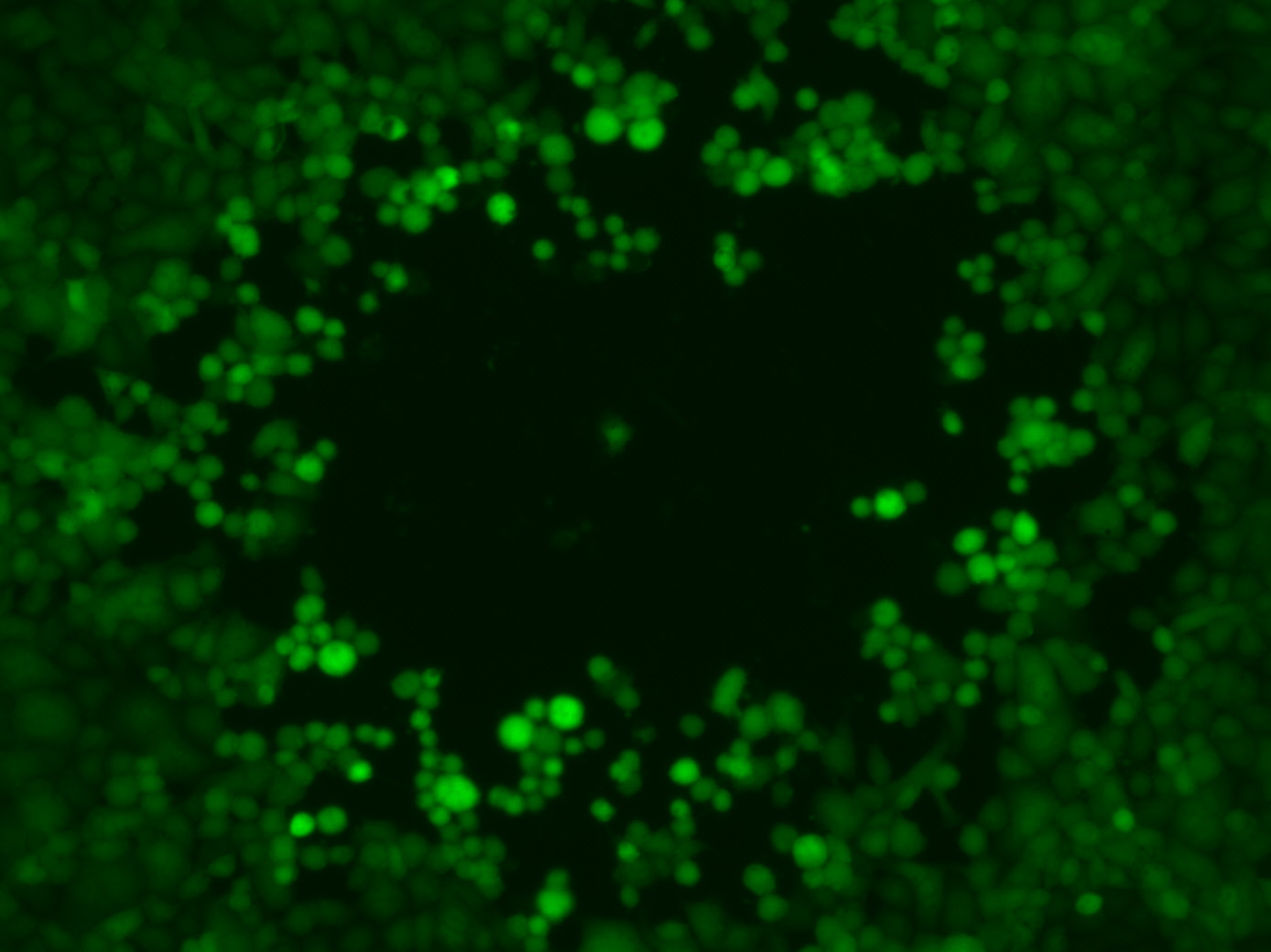 Plaquebildung durch grün fluoreszierende HSV1-Viren.