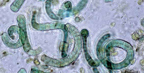 Mikroalge Spirulina platensis, 1000fache Vergrößerung.