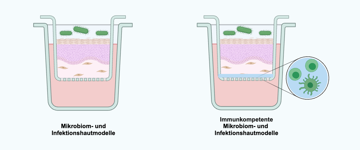 Schematische Darstellung der 3D-Hautmodelle unterschiedlicher Komplexität als immunkompetenten Mikrobiom- und Infektionsmodelle sowie als immunkompetente Mikrobiom- und Infektionsmodelle. 