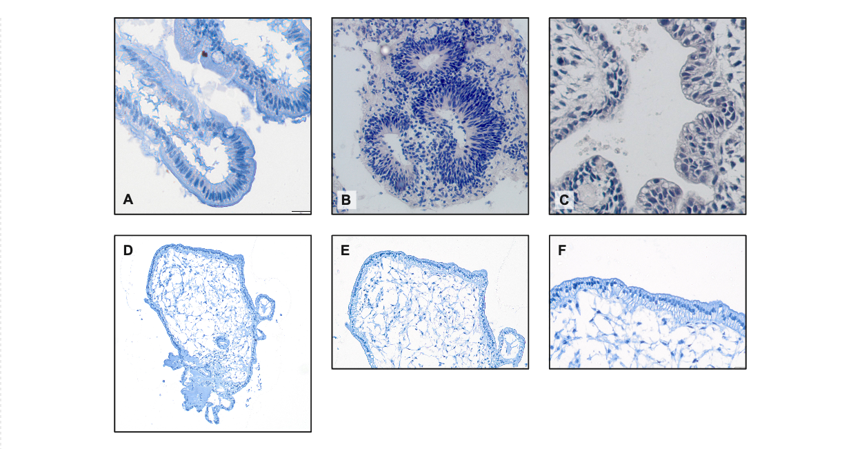 Hellfeldmikroskopieaufnahmen von Hämatoxylin-Eosin-gefärbten Gewebedünnschnitten von  A) ex-vivo Dünndarm B) und C) Organoiden mit apikaler Seite nach innen zeigend D - F) Insite-Out-Darm-Organoide mit apikaler Seite nach außen zeigend. 