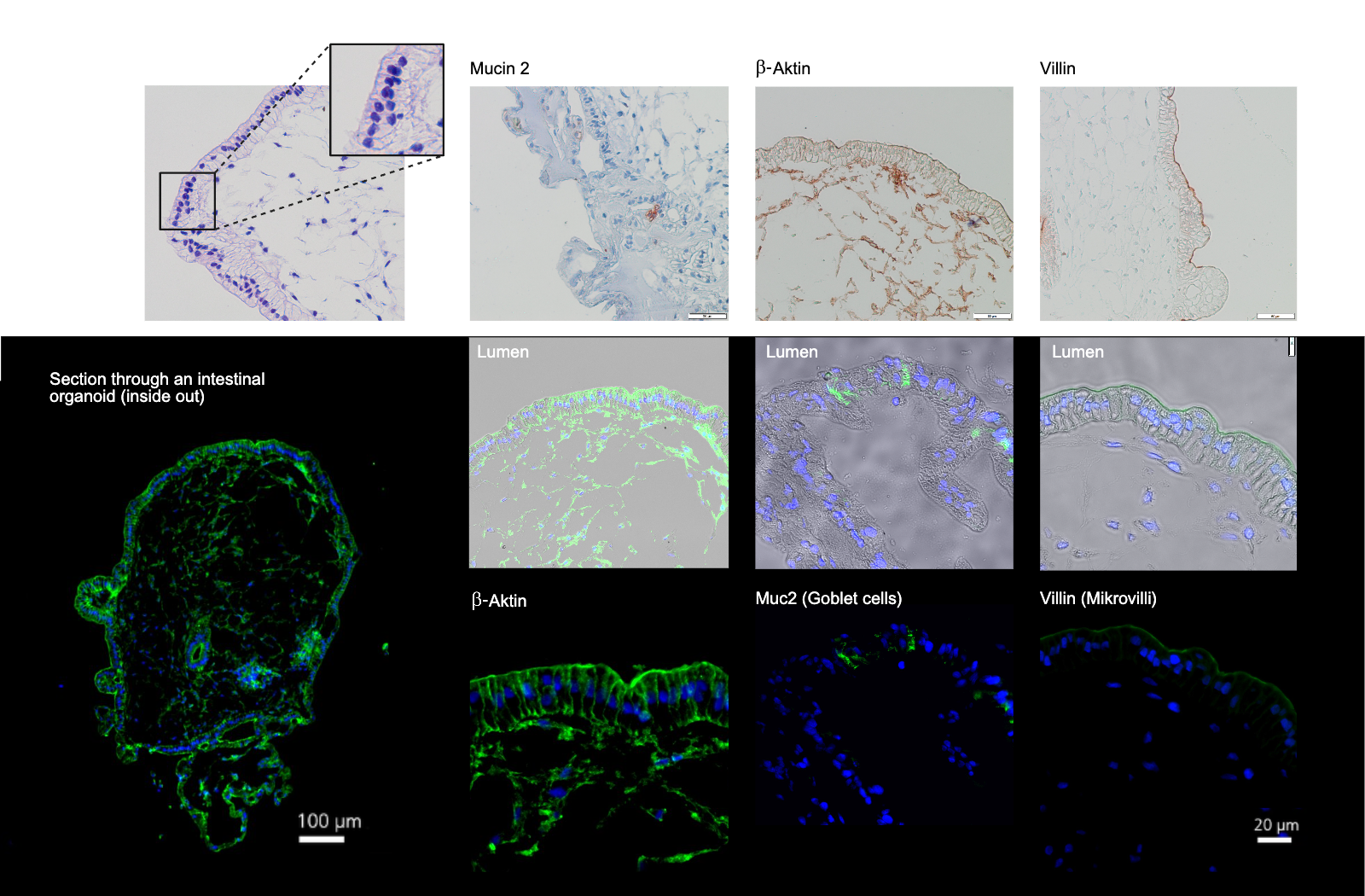 Gewebeaufbau und Proteinmarker intestinaler Organoide entsprechen exakt dem Expressionsmuster des humanen In-vivo-Dünndarms (Immunhistochemische Färbungen von Gewebedünnschnitten auf die darmspezifischen Expressionsmarker β-Aktin, Mucin 2 und Mikrovillin).