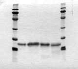 SDS-PAGE von Varianten des humanen Interferon-gamma.