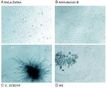 Phasenkontrastbilder des HTS-Testsystems.
