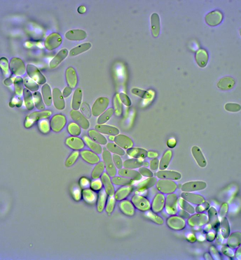 Candida-Zellen und Bildung von Dicarbonsäure (DCA) aus Ölsäuremethylester (OME).