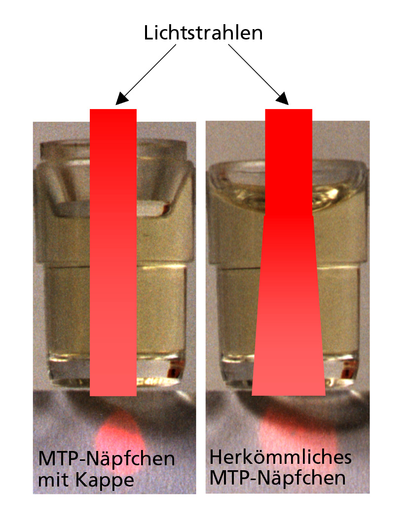 MTP Meniskus