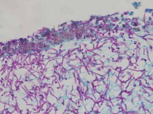 Infektionsmodell von Candida albicans.