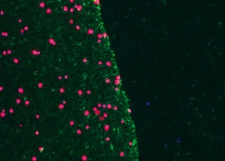 Mesenchymale Stammzellen (rot) auf Albumin­beschichtung (grünlich fluoreszierend) und unbeschichtetem Ti6Al4V (schwarz) nach einer Minute.