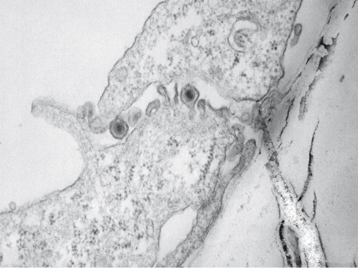 TEM-Aufnahme einer mit HSV-1 infizierten Zelle auf einem Kokulturträger.
