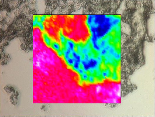 Particle distribution in tissues.