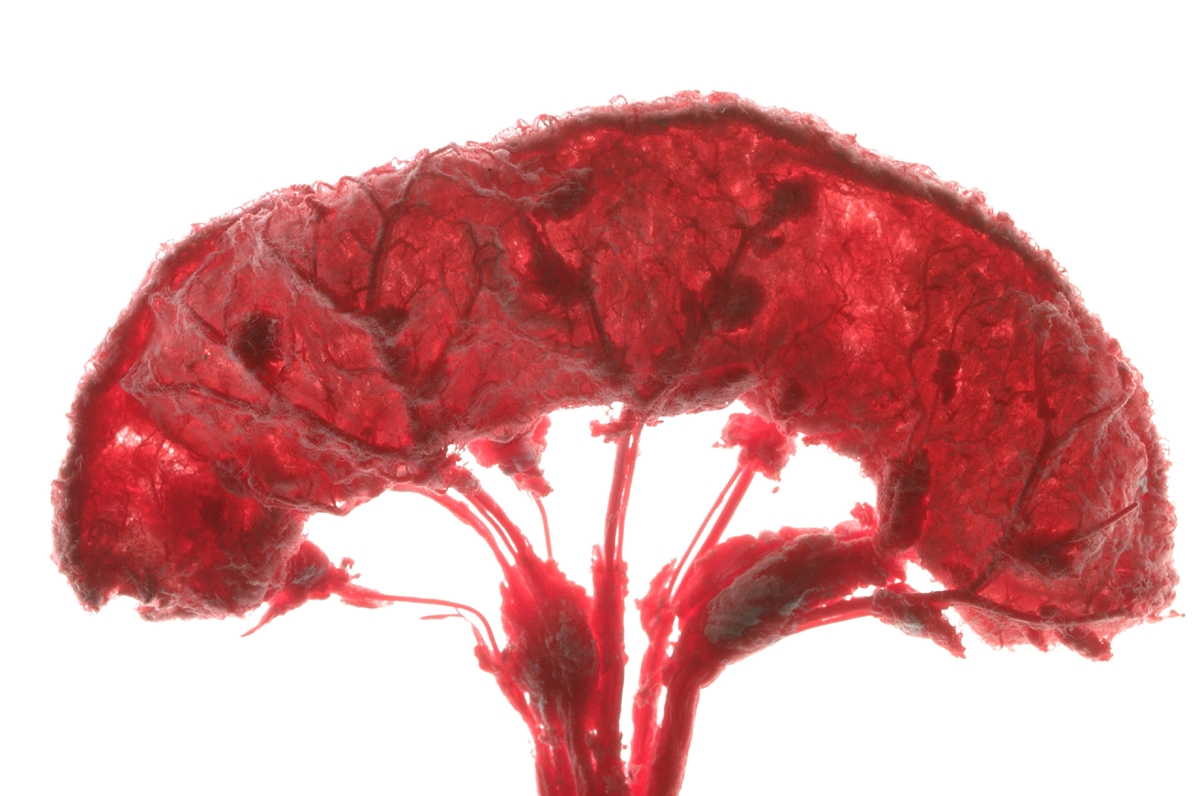3-D-Vascular-Testsystem