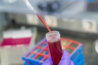 Probe mit Blut Für das neue, nicht invasive Diagnostikverfahren wird zellfreie DNA aus dem Blut von Patienten isoliert.