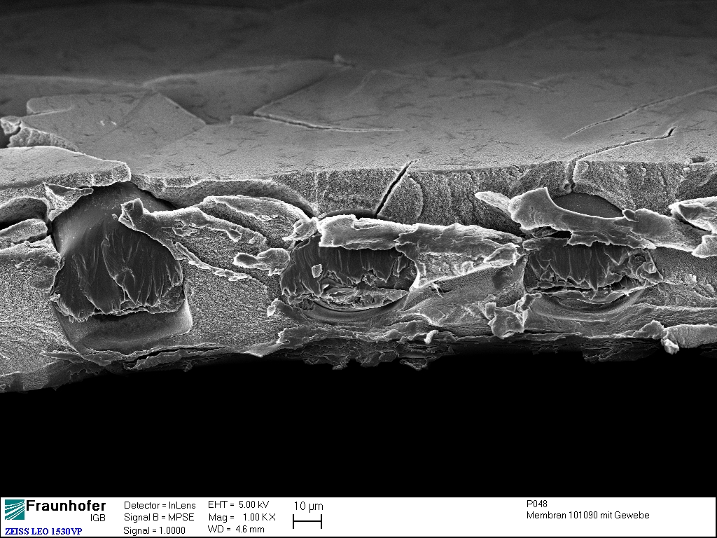 Cellulose acetate membrane under electron microscope