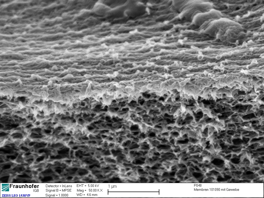 Cellulose acetate membrane (enlarged section of the interface) under electron microscope