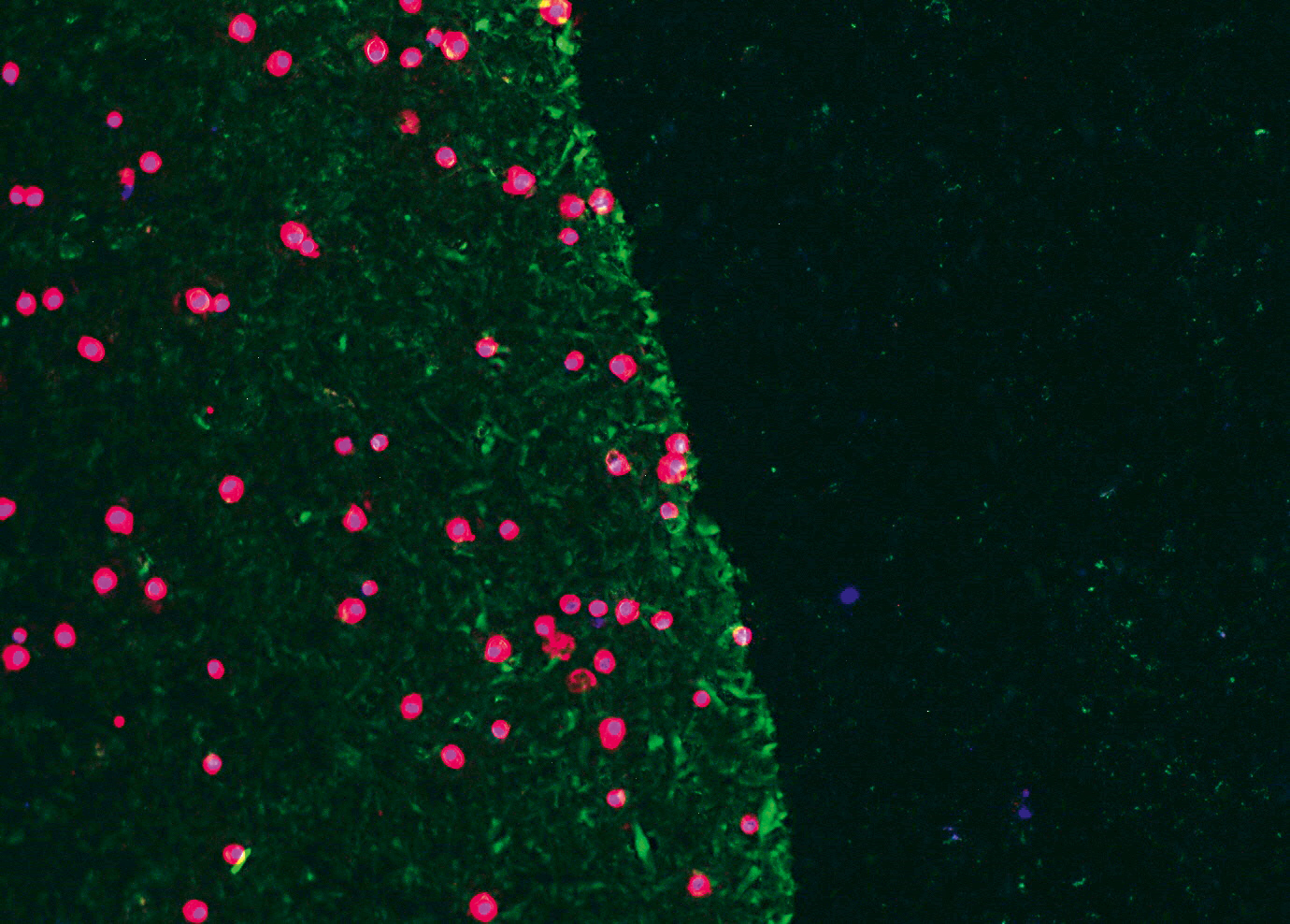 Early stem cell (red) adhesion on albumin coating (green) after one minute.