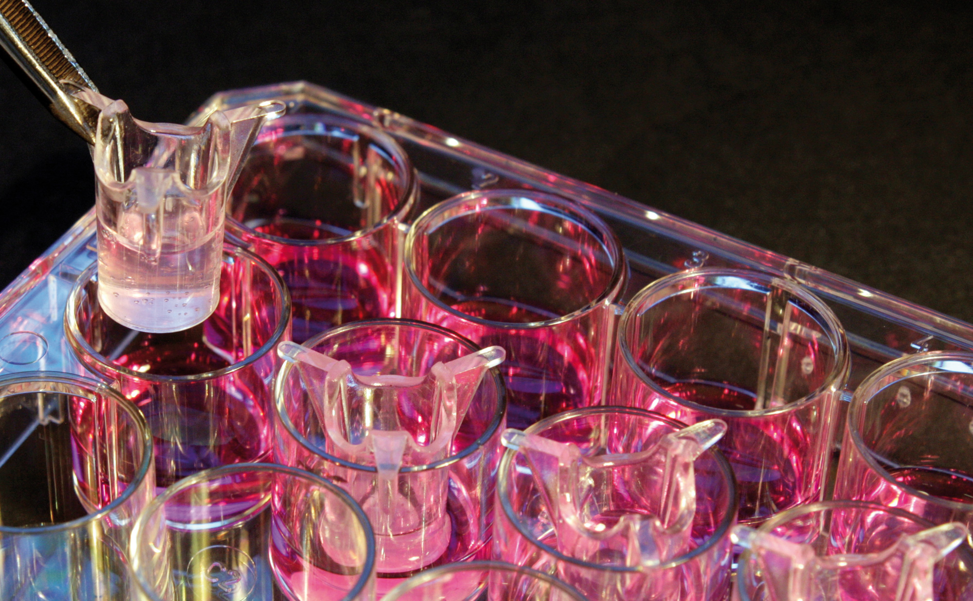 Development of an in vitro infection model. Development of an in vitro infection model.