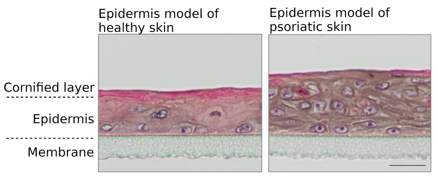 Cross-section through a 3D in-vitro psoriasis model. The disturbed keratinization (pink) and thickening (acanthosis) of the epidermis are typical for the disease.