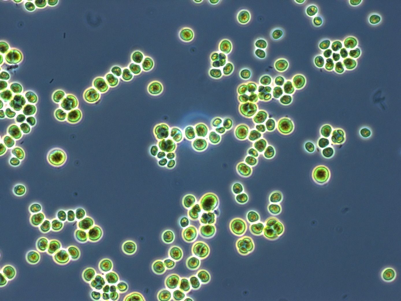 Microscopic image of the microalga Chlorella, 1000x magnification.