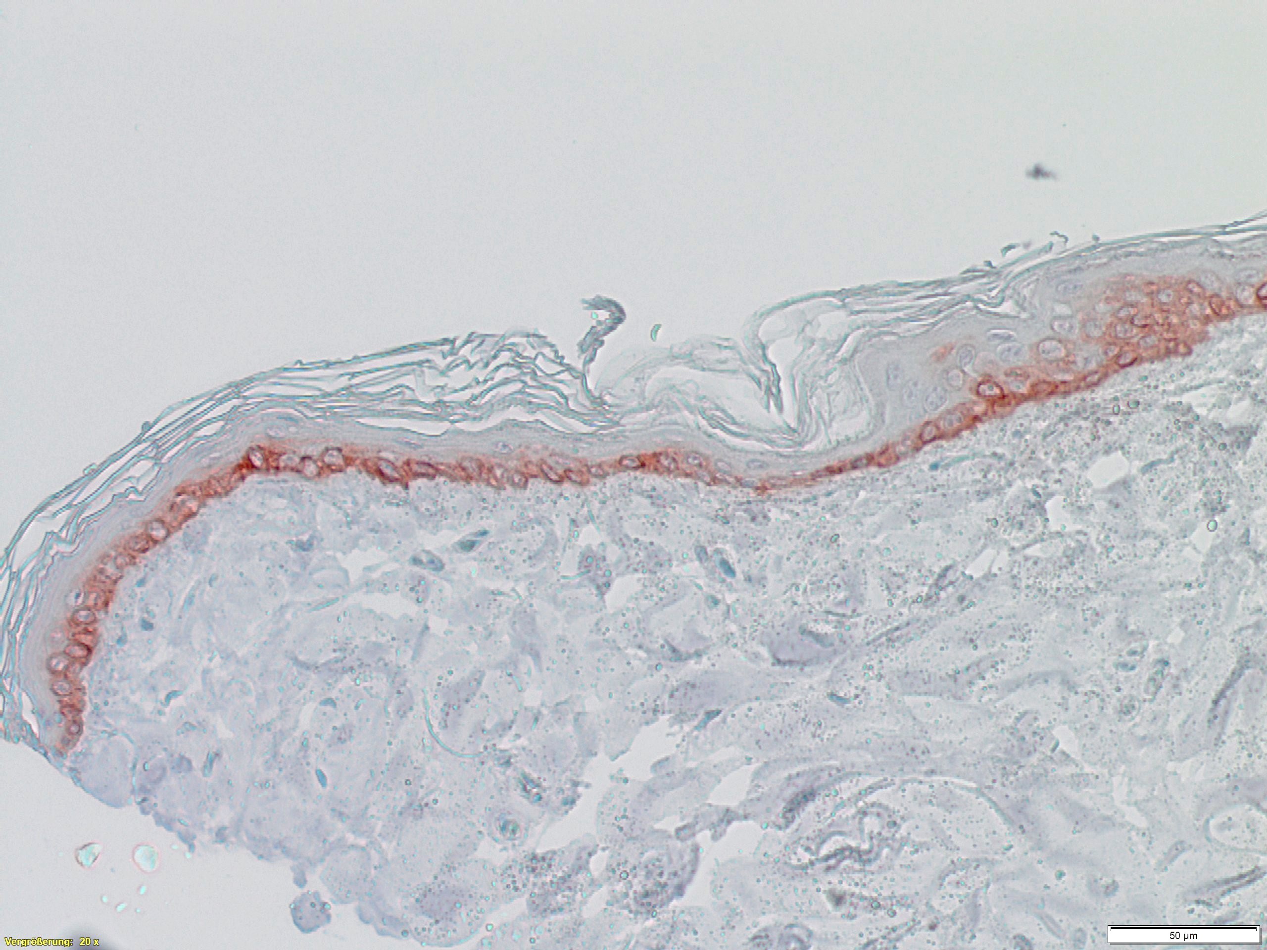 Canine skin, immunohistochemical staining of CK14 (scale bar equals 100 µm)