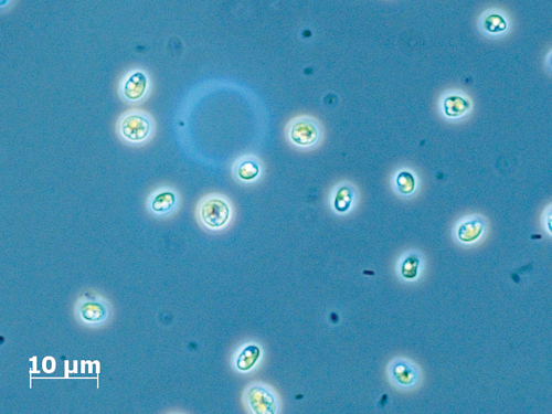 Chlorella vulgaris with deposited storage lipids.