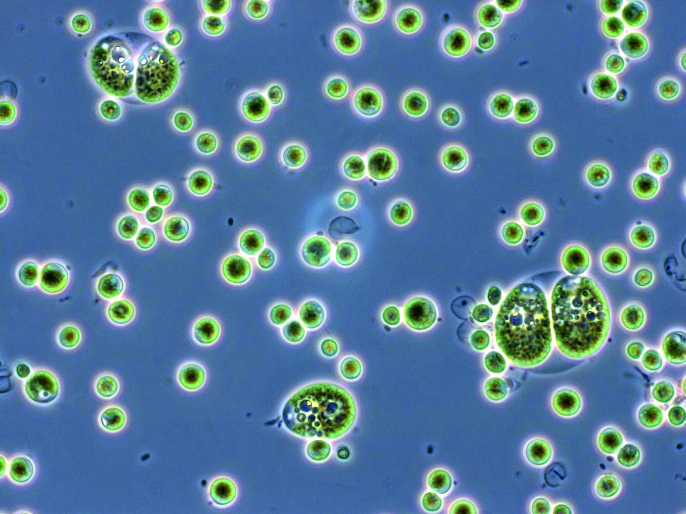 Microscopic image of the microalgae tested