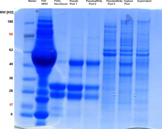 SDS gel electrophoresis of the reference substances and the purification levels of factor VII.