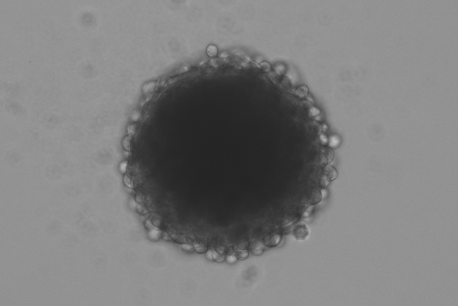 Mikroskopische Aufnahme eines Fibroblasten-Sphäroids
