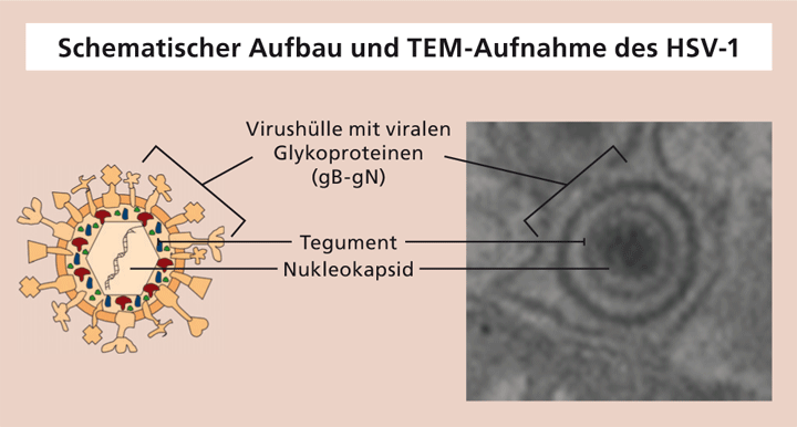 Schematic composition and TEM image of HSV-1.