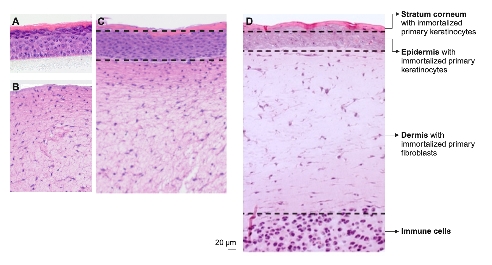 Histological sections of human 3D skin models: A) reconstituted epidermis model, B) reconstituted dermis model and C) reconstituted full-thickness skin model are tissue-typical. D) Immunocompetent skin model in which a full skin model was supplemented with immune cells in a collagen matrix.