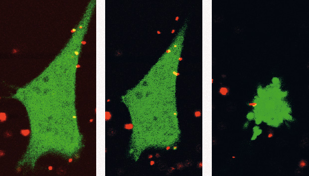 TNF Nanocytes Apoptose L.