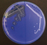 Chitinolytic bacteria on agar plates.