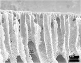 Scanning electron microscope image of a membrane.