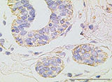 Immunohistochemical analysis of TβRII  in breast tissue.