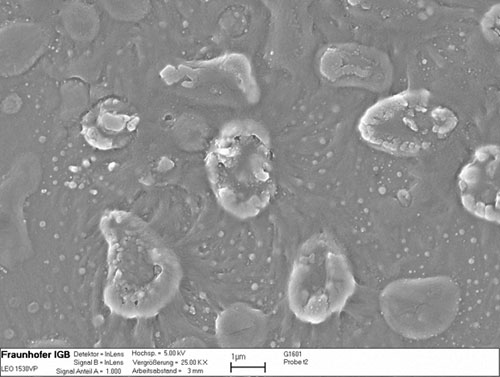 Bild 3b: REM-Aufnahme mit Schallimpulsen geschädigte/aufgelöste Zellen von Sarcina lutea