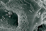 Scanning electron micrograph of a particle overgrown with sulfate reducing bacteria (3000-fold).
